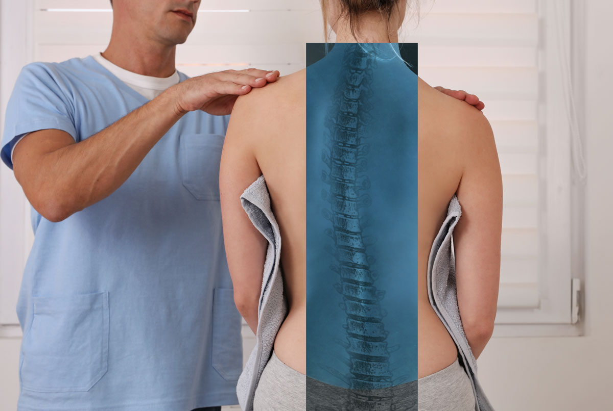 Scoliosis Relief at Core Posture in Newport Beach Scoliosis Relief at Core Posture in Newport Beach