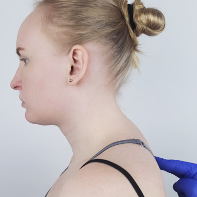 How to Fix a Neck Hump width=