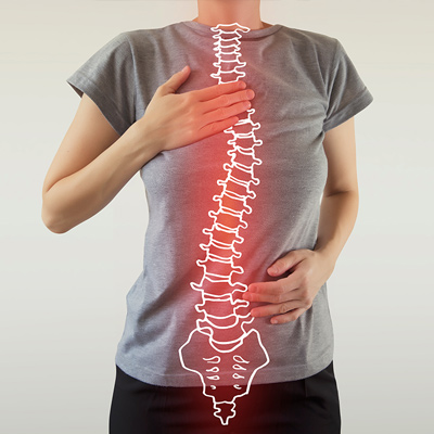 Scoliosis Bracing in Orange County