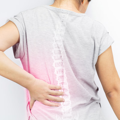 How to Check for Scoliosis at Home