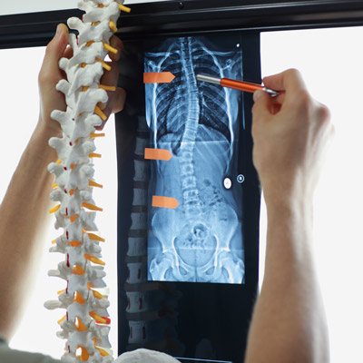 x-ray in corrective chiropractic care