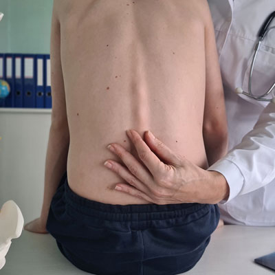 Scoliosis in Teenagers